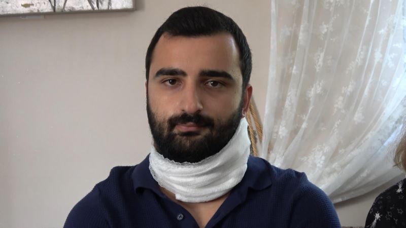 Jiletli Saldiriya Ugrayan Doktor: Geceleri Uyaniyorum, Biri Saldiracakmis Gibi Hissediyorum