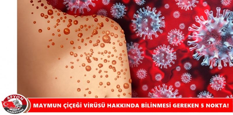 MAYMUN ÇIÇEGI VIRÜSÜ HAKKINDA BILINMESI GEREKEN 5 NOKTA!